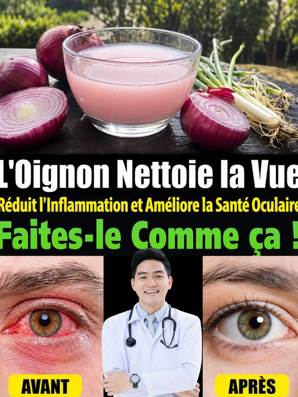 Le Secret Choquant : Récupérez une Vue Éblouissante en SEULEMENT 5 Jours Grâce à l'Oignon (Et Sauvez Vos Reins et Votre Diabète !)