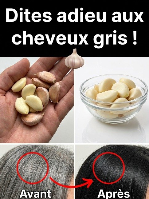Le Secret Viral Anti-Cheveux Gris : Ce Duo Ail & Clous de Girofle Va Révolutionner Votre Chevelure (Adieu les Colorations !)