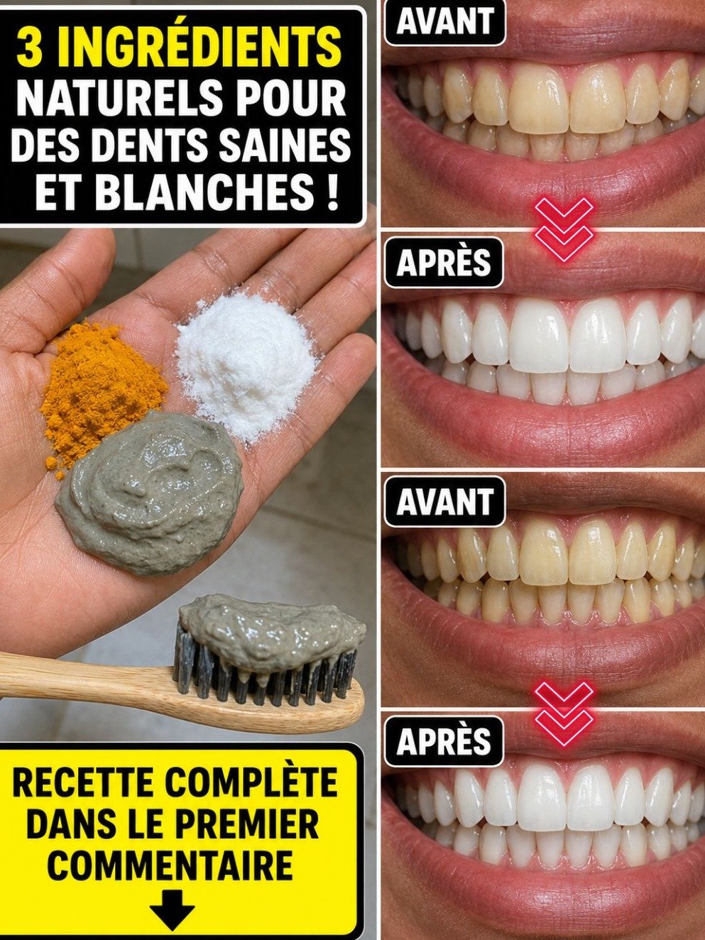 Le Secret Révélé : Ayez des Dents Éclatantes en SEULEMENT 2 Minutes (Oubliez les Traitements Coûteux) !