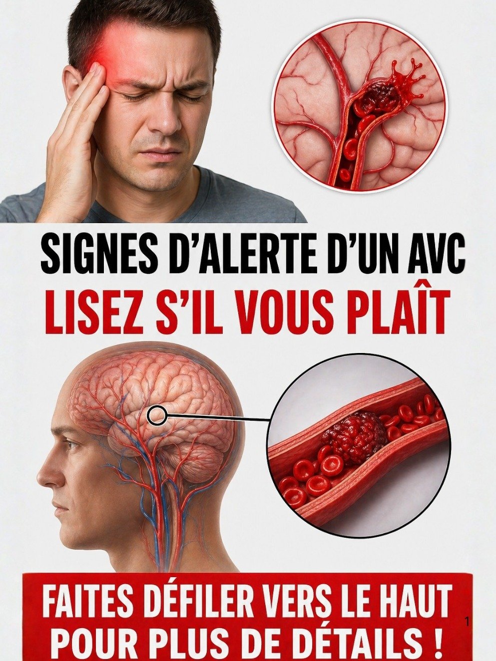 AVANT qu'il ne soit trop tard : Les 4 signes cachés d'un AVC que VOUS devez absolument connaître pour réagir en urgence !