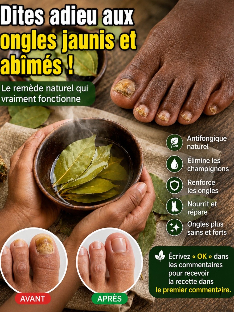 Le Secret Ancien Révélé : Dites Adieu aux Ongles Fragilisés avec ce Remède Naturel au Laurier (Ça Marche VRAIMENT) !
