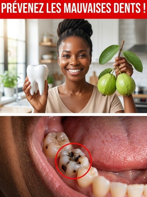 STOP à la douleur dentaire ! 3 secrets ANCIENS aux feuilles de goyavier que votre bouche va ADORER (Naturel & Économique)