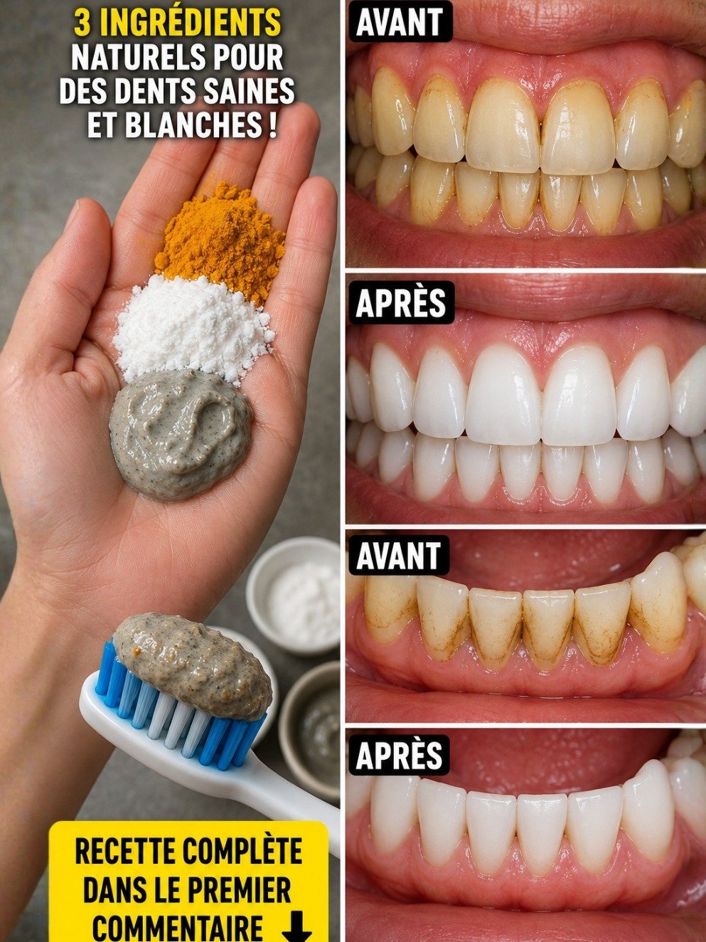 😱 2 Minutes Chrono pour des Dents BLANCHES Éblouissantes : La Révélation Naturelle que vous DEVEZ Connaître !