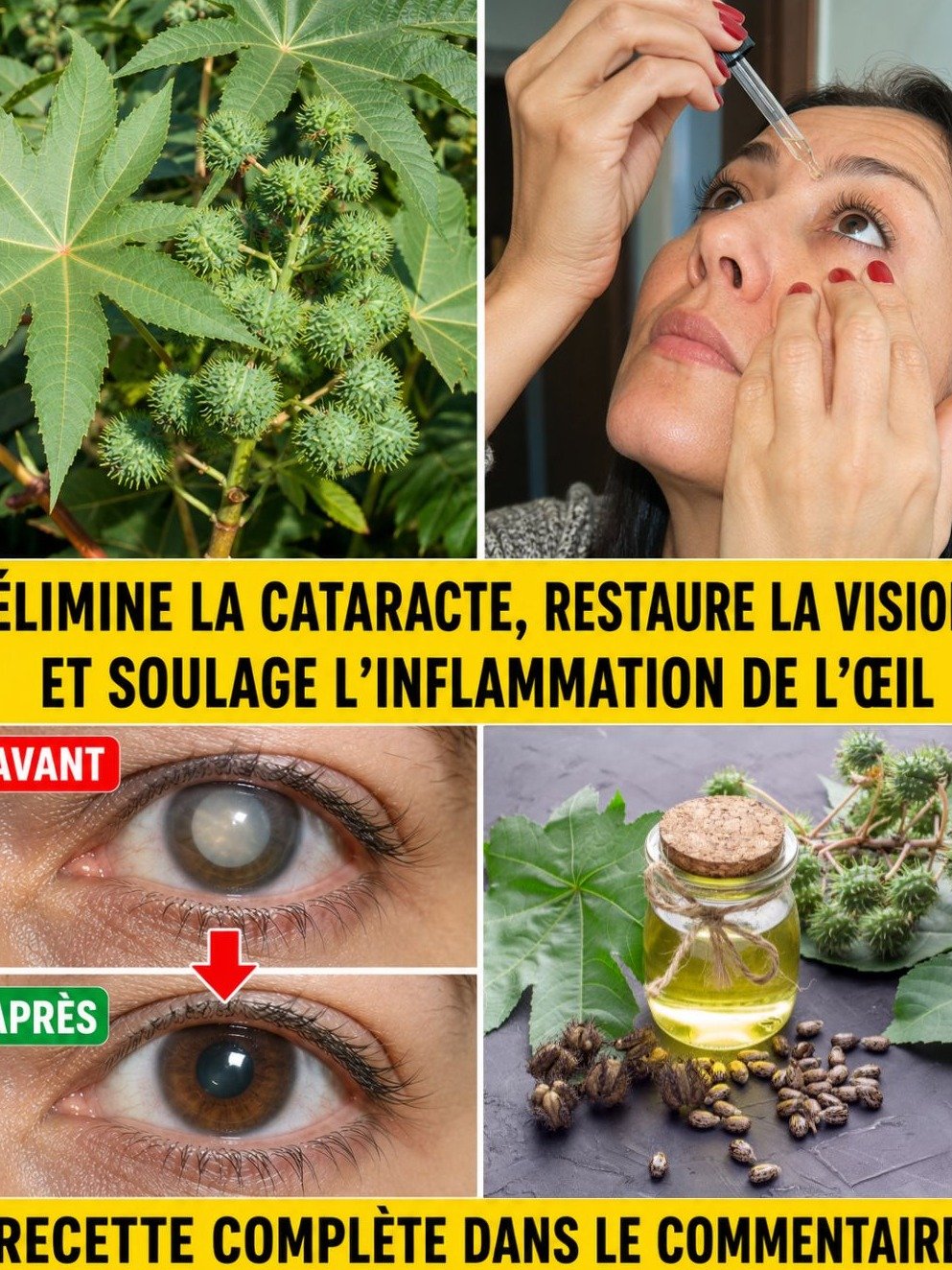 Le Remède Naturel SECRET pour une Vision Éclatante : Dites Adieu à la Cataracte et à l'Inflammation Oculaire !