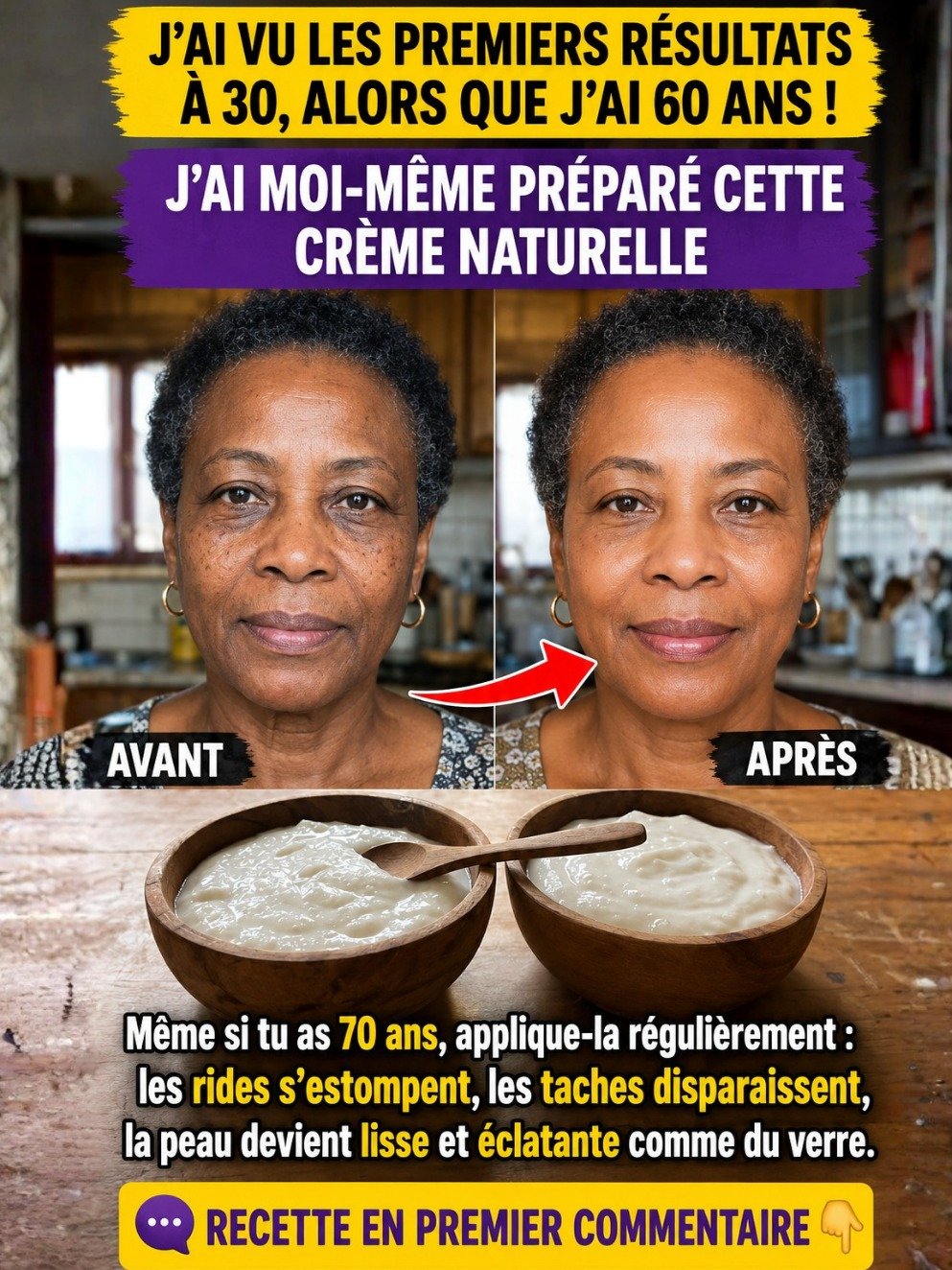 Le Secret ANTI-ÂGE Révélé : Cette Crème Maison au Bicarbonate de Soude Efface Rides et Taches en Un Clin d'Œil !