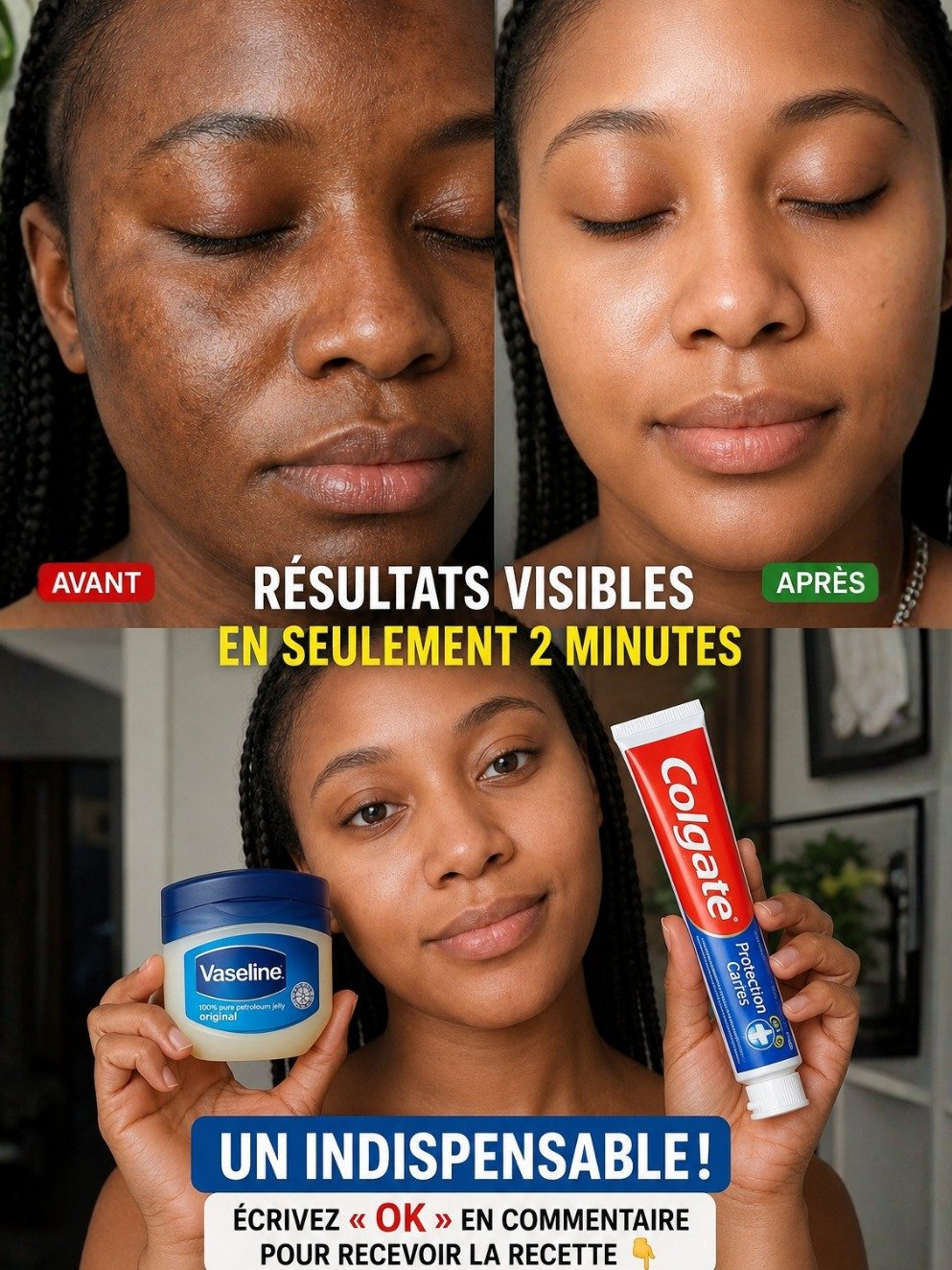 Révélation Choc : Ce Que Les Femmes de Plus de 50 Ans NE SAVENT PAS sur la Vaseline et le Dentifrice pour une Peau Éclatante !