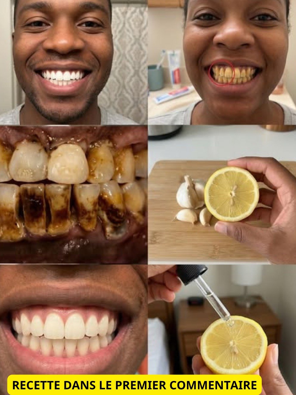 Dents Jaunes ? Ce secret de 2 minutes que les dentistes NE veulent PAS que vous sachiez (ou presque) pour un sourire éclatant !