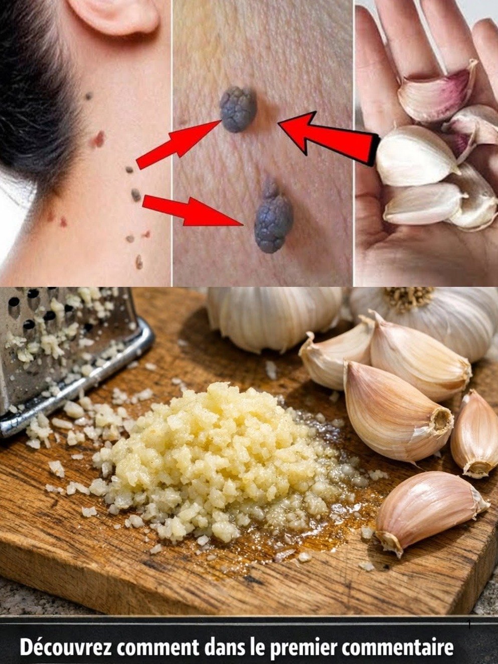 Le Secret Caché de Votre Cuisine : L'Ail Va Révolutionner la Santé de Vos Pieds (Et Personne Ne Vous L'a Dit !)