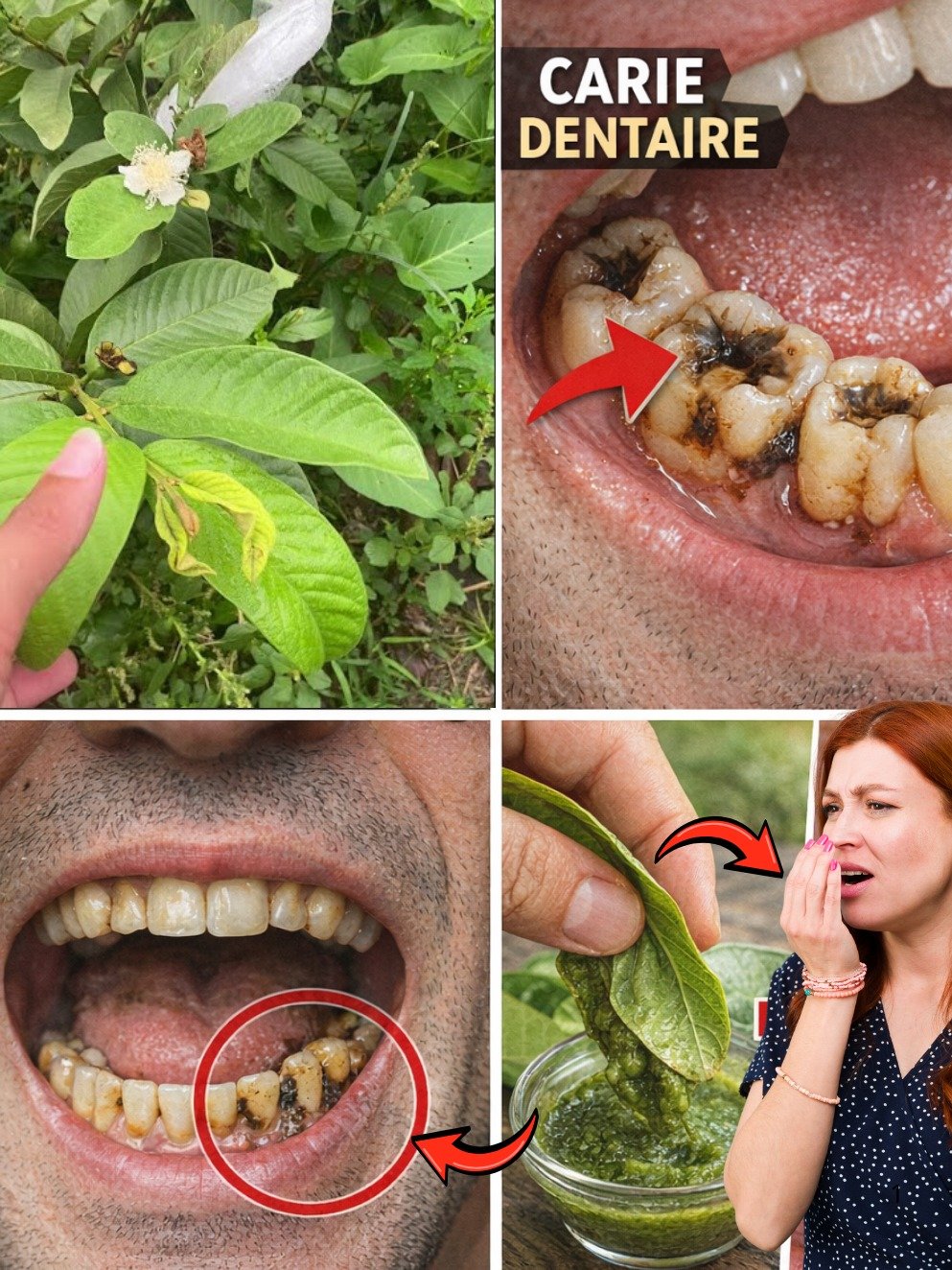 Le Secret Oublié pour des Dents Incroyables : 3 Façons Simples d'Utiliser les Feuilles de Goyave (À Essayer ABSOLUMENT !)