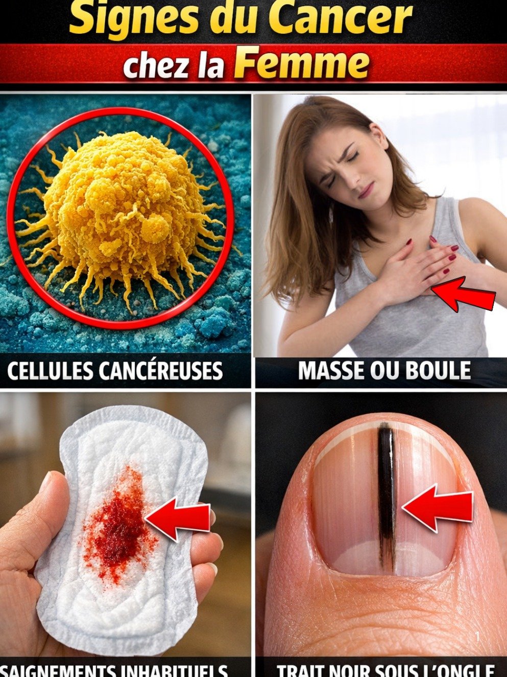 ALERTE SANTÉ : 14 Signes Cachés de Cancer chez les Femmes que 90% Oublient – Le N°13 va vous SURPRENDRE !