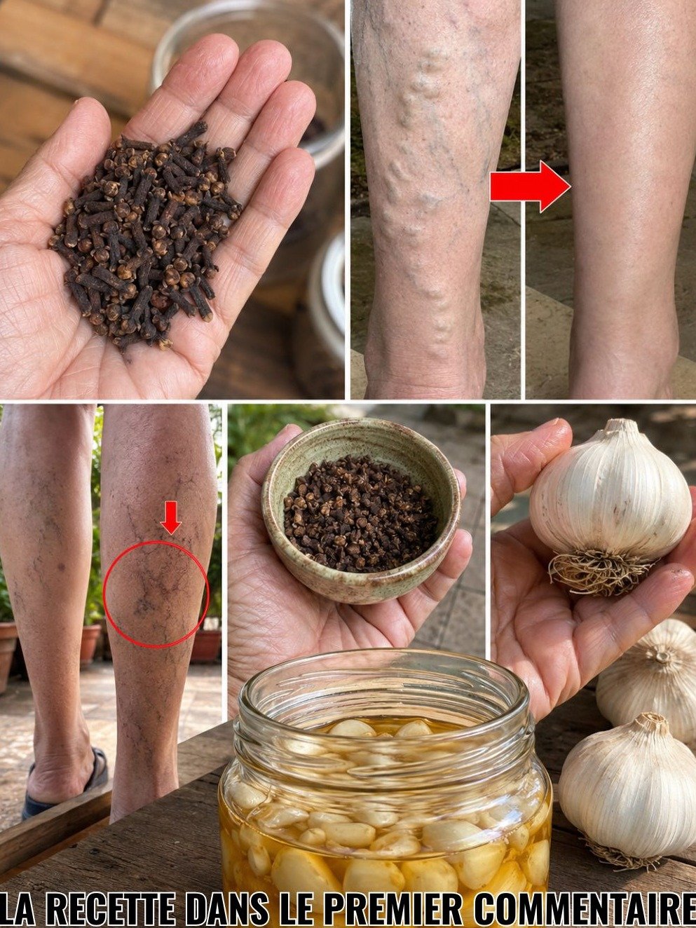 Le Secret ANTI-VARICES le Mieux Gardé : Cette Huile Maison Étonnante Va Révolutionner Vos Jambes !