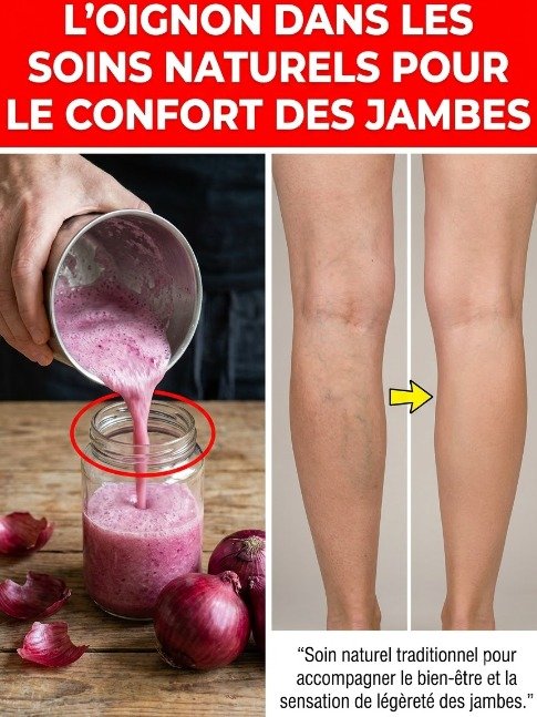 Varices : Le secret naturel (oignon, ail, gingembre) qui fait trembler l'industrie pharmaceutique