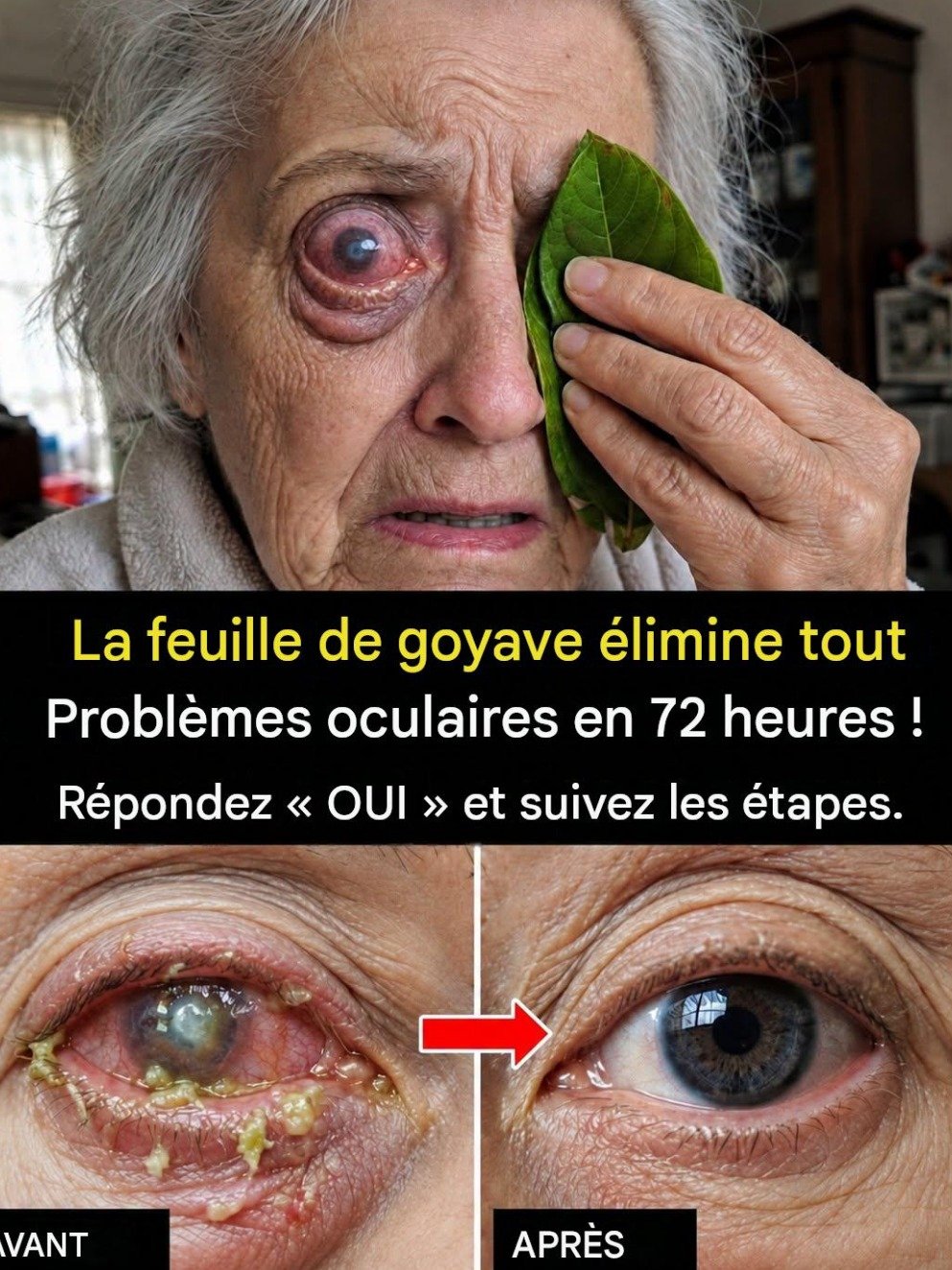 Le Secret des Feuilles de Goyavier pour Votre Vue après 60 ans : Mythe ou Réalité ? Ce Que Vous DEVEZ Absolument Savoir Avant d'Agir !