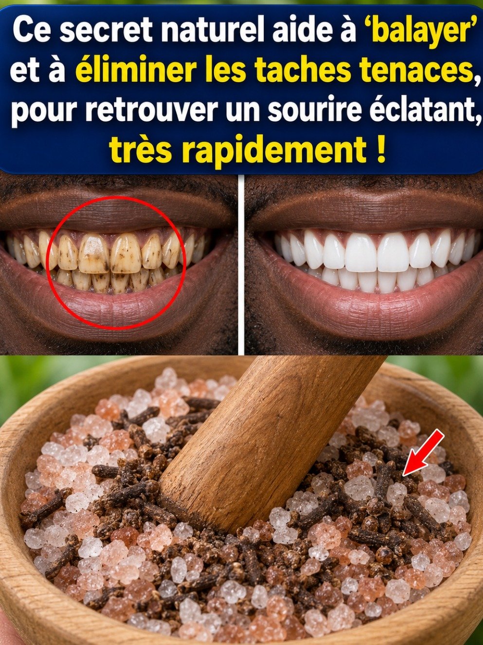Le secret ancestral du clou de girofle pour éradiquer la plaque dentaire et apaiser vos gencives (sans produits chimiques)