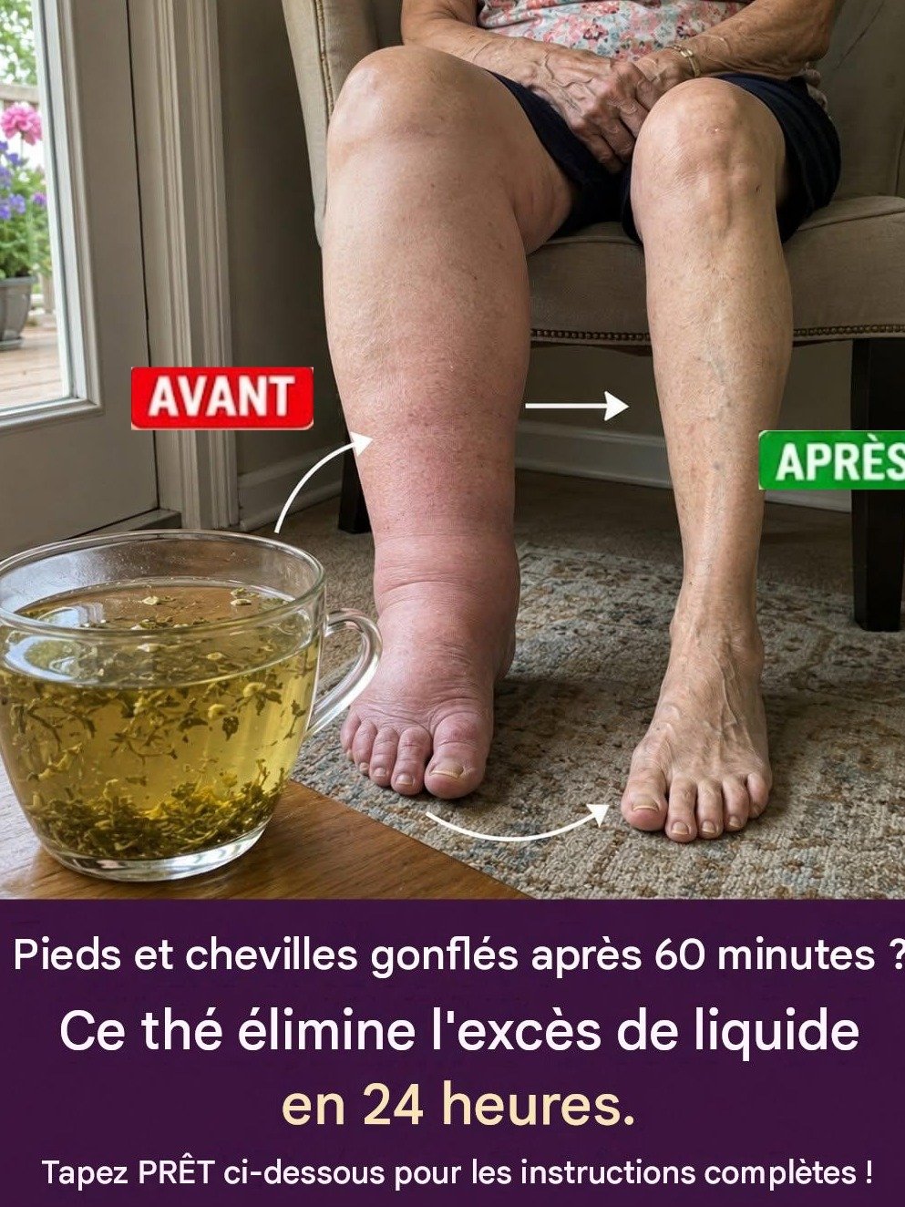 Le Secret Insoupçonné : Après 60 ans, vos pieds et chevilles gonflent la nuit ? Cette tisane ultra-simple ÉLIMINE le liquide retenu !