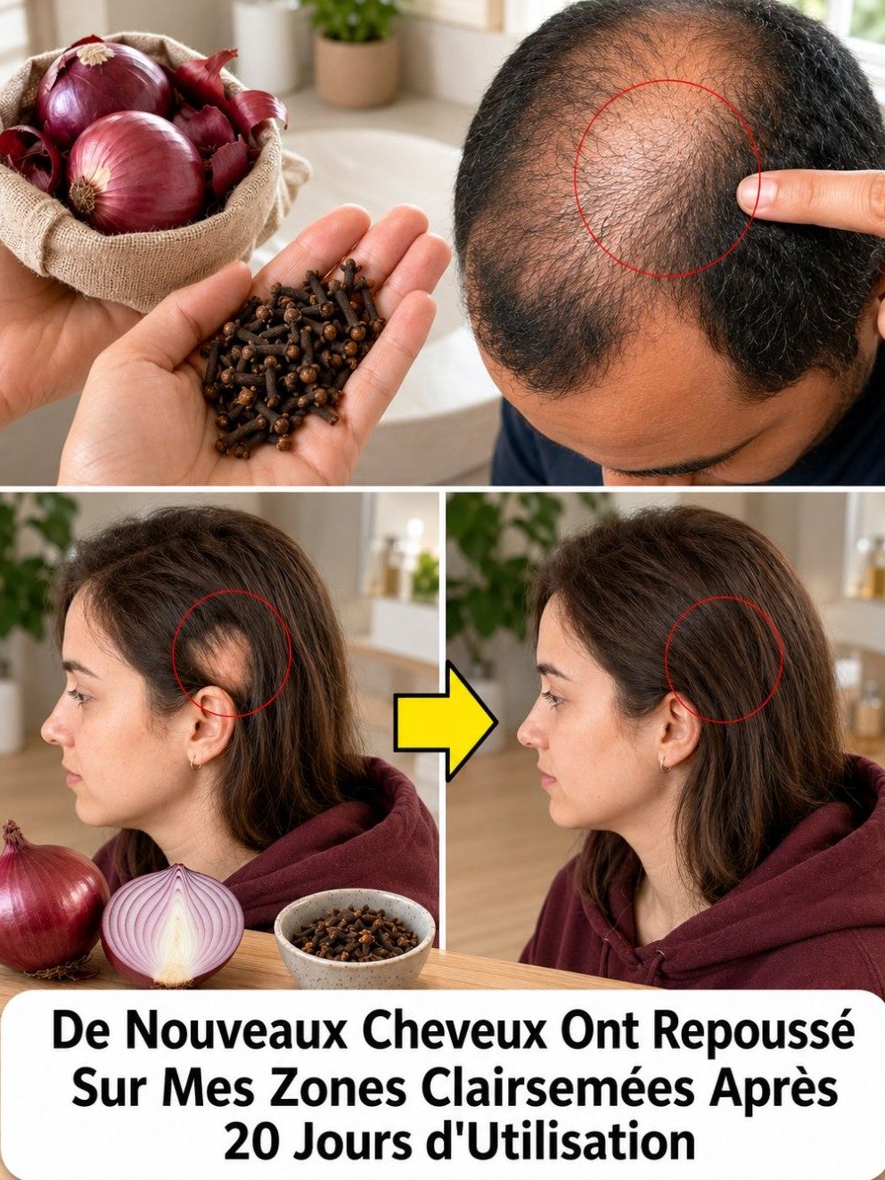Le Secret Insoupçonné pour des Cheveux de Rêve : 4 Recettes Virales à l'Oignon (Vous Ne Le Croirez Pas !)