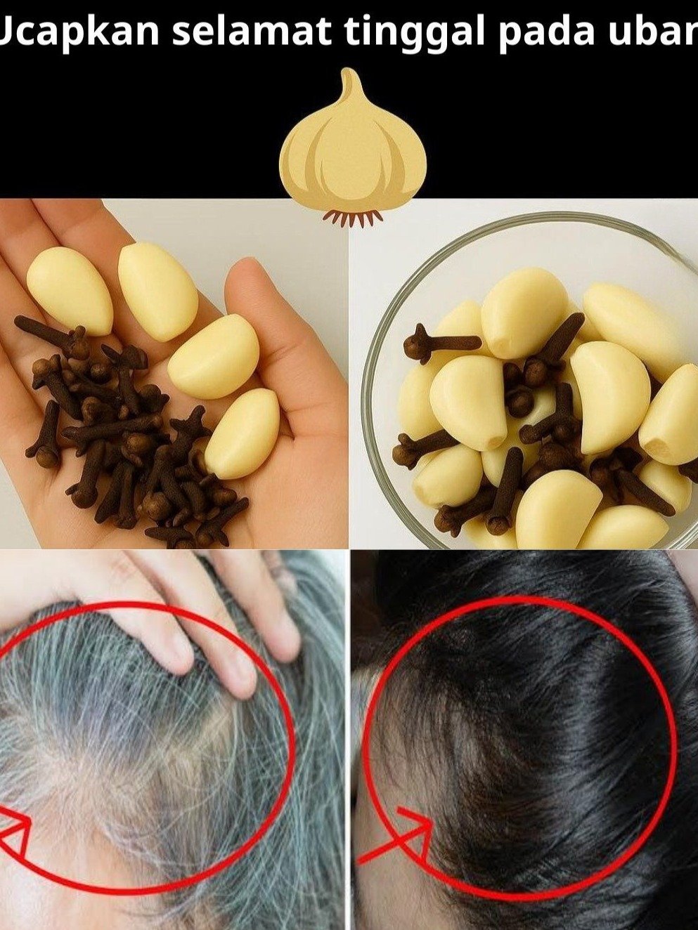 Adieu aux cheveux blancs : l'astuce naturelle surprenante à base d'ail et de clous de girofle