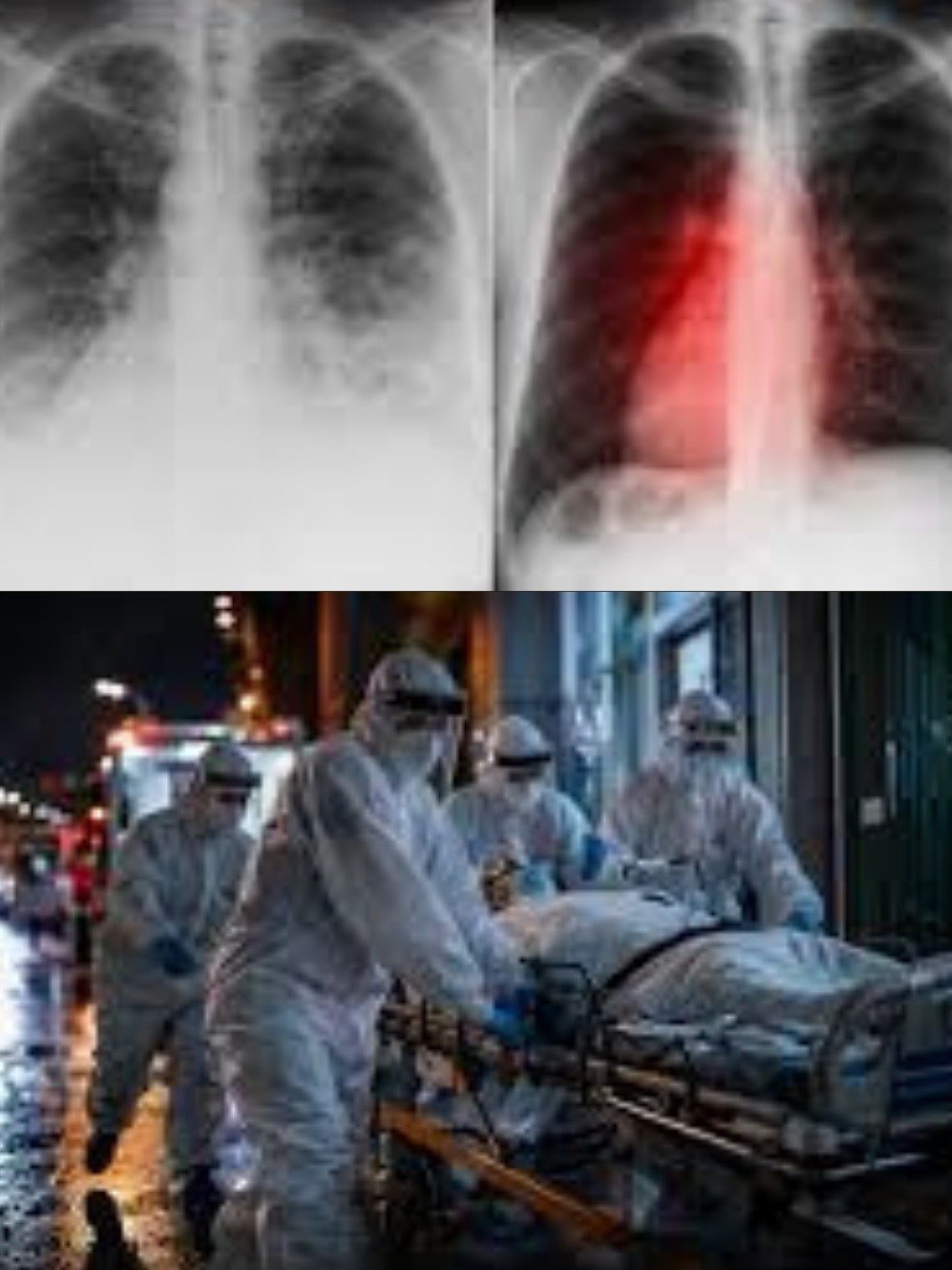 Vaccins COVID-19 : Les Révélations Inattendues d'une Étude Colossale sur 99 Millions de Personnes (Ce Que Vous DEVEZ Savoir)
