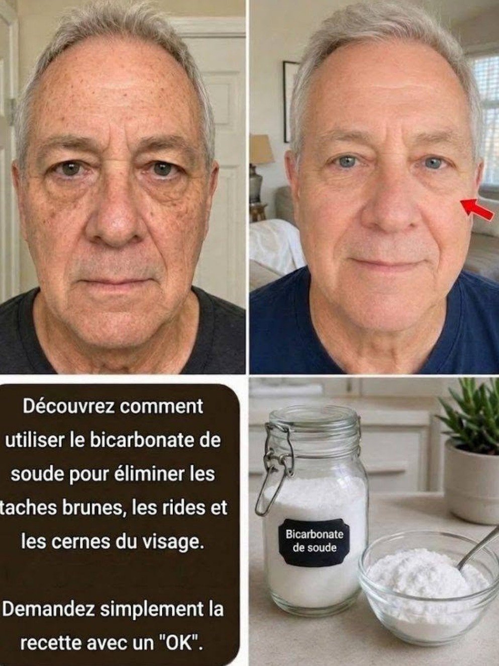 Bicarbonate de soude sur le visage : Le danger caché que personne ne vous dit