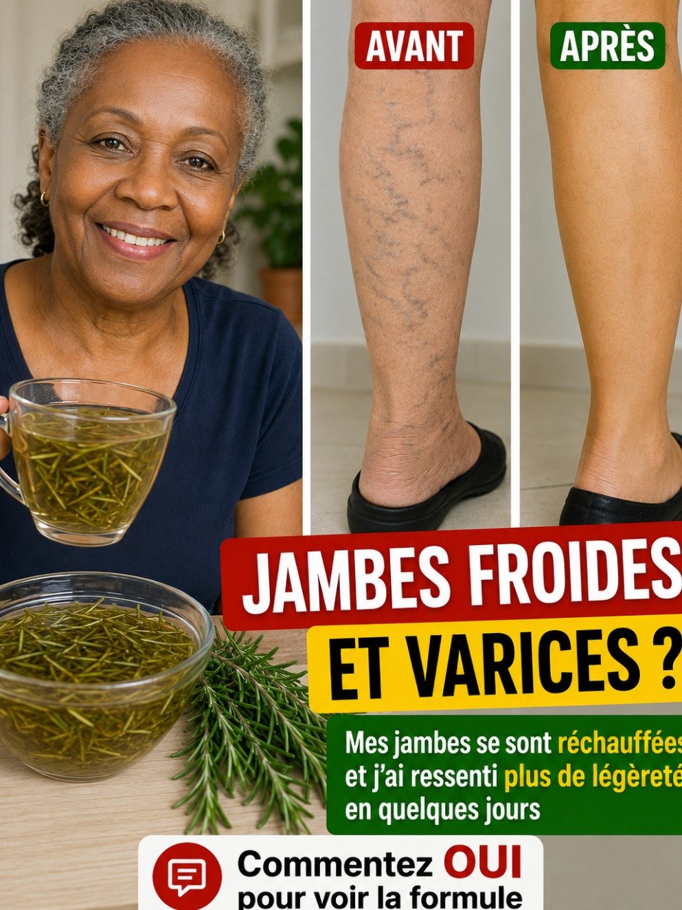 Jambes lourdes et varices : Le secret naturel méconnu pour relancer votre circulation