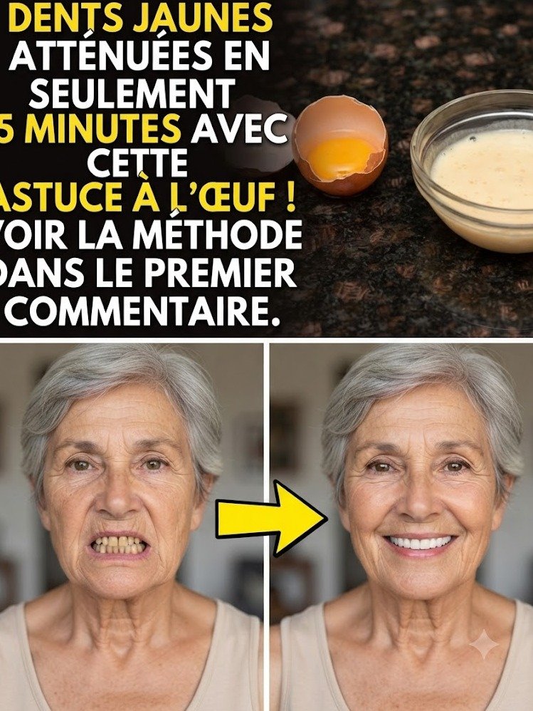 Dents Jaunes ? Ce SECRET à l'Œuf Va Changer Votre Sourire pour Toujours (L'Industrie du Blanchiment DÉTESTE ça !)