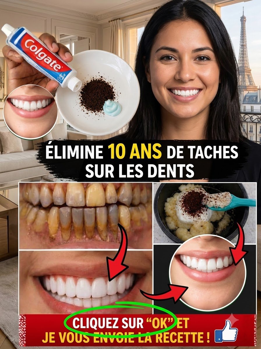 Le Secret Choc de 2 Minutes : 99% des Plus de 60 Ans NE CONNAISSENT PAS cette Astuce pour des Dents sans Taches !