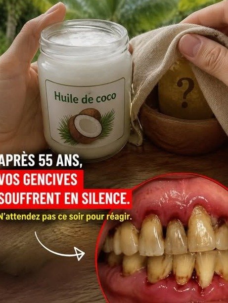 À 55 ans, cette huile de coco fait saigner les gencives... puis les transforme en 7 jours