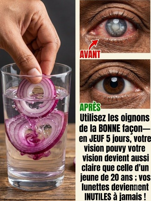 Vision floue : Le secret de l'oignon rouge que l'industrie ne veut pas que vous sachiez