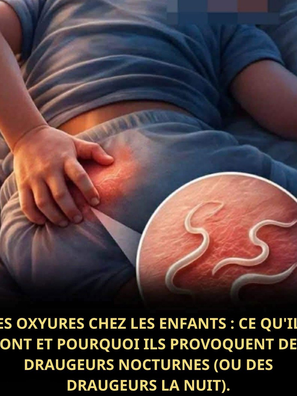 Les Démangeaisons Nocturnes Vous Rendent Fou ? Le Guide ULTIME pour Éradiquer les Oxyures et Retrouver un Sommeil Paisible !