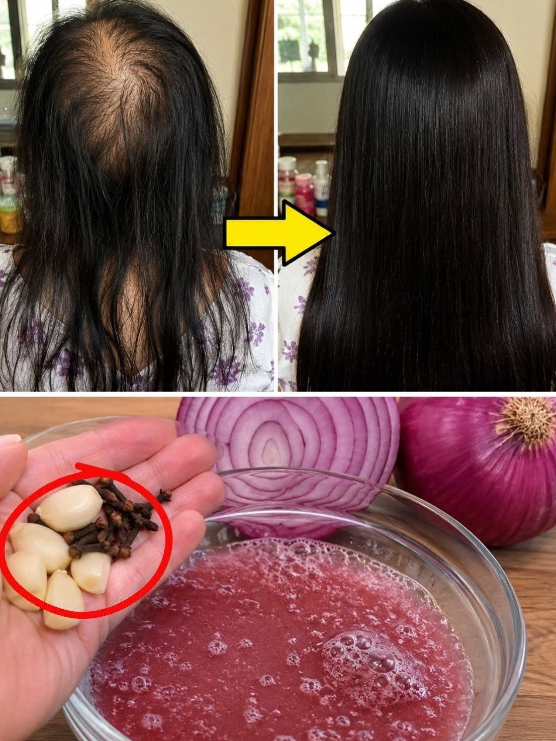 Le secret capillaire ignoré des grandes marques : pourquoi l’oignon pourrait sauver vos cheveux