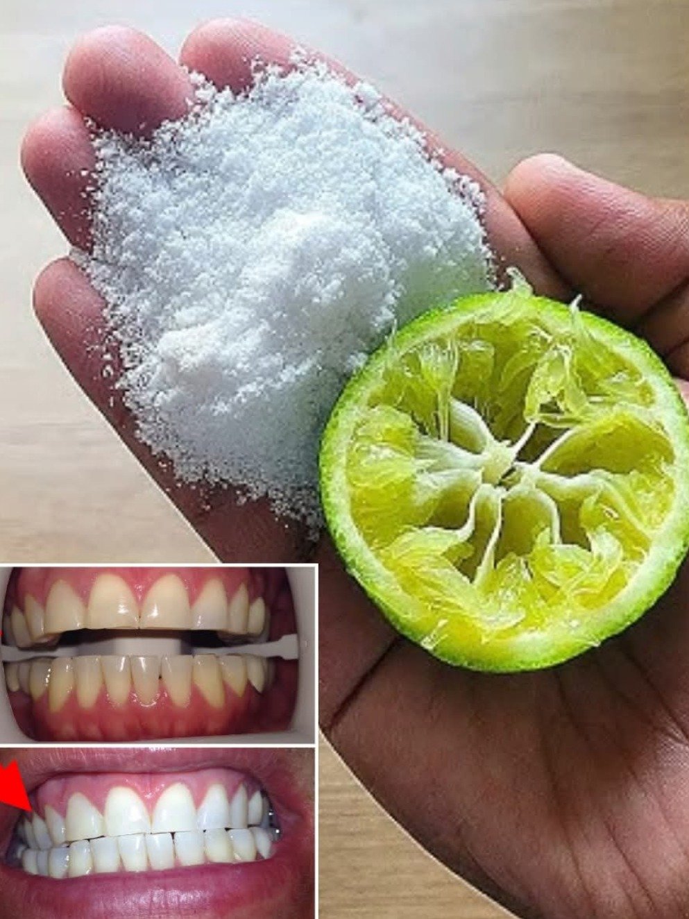 Ne détruisez pas votre émail : pourquoi cette astuce virale de blanchiment des dents est un piège dangereux