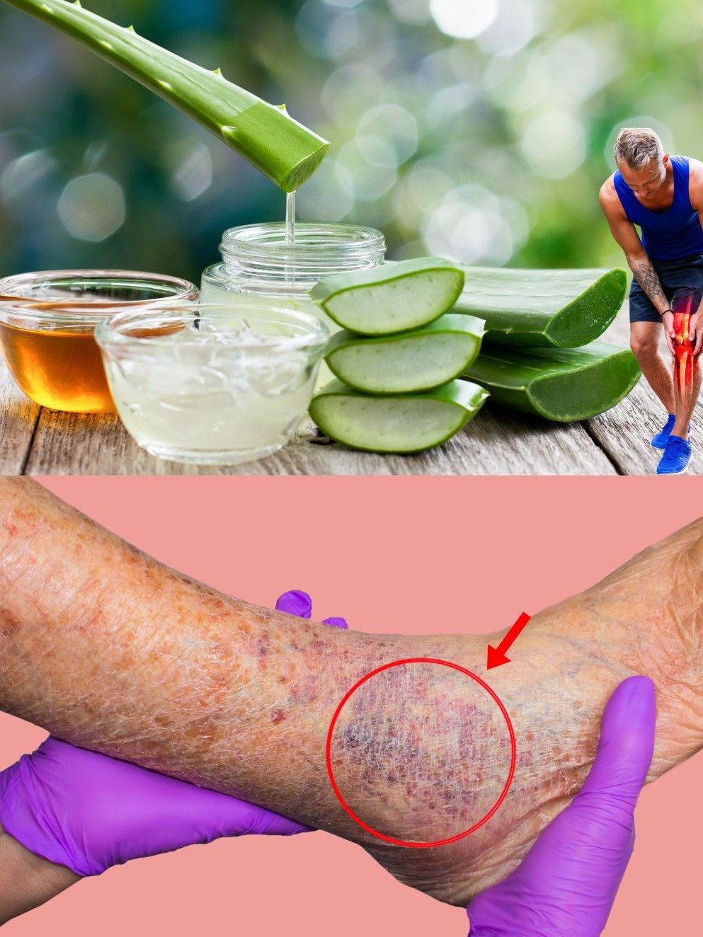 Marre des jambes lourdes et gonflées ? Ce secret à l'aloe vera va vous BLUFFER (Le soulagement que vous attendiez !) 🌿