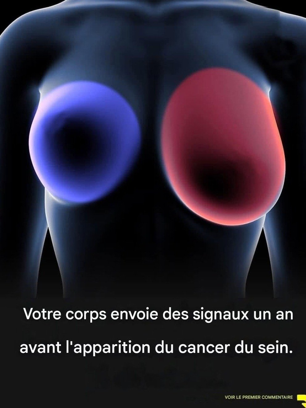 Ne PAS lire cet article est un risque : 4 signaux INSIDIEUX du cancer du sein que chaque femme DOIT connaître AVANT qu'il ne soit trop tard !