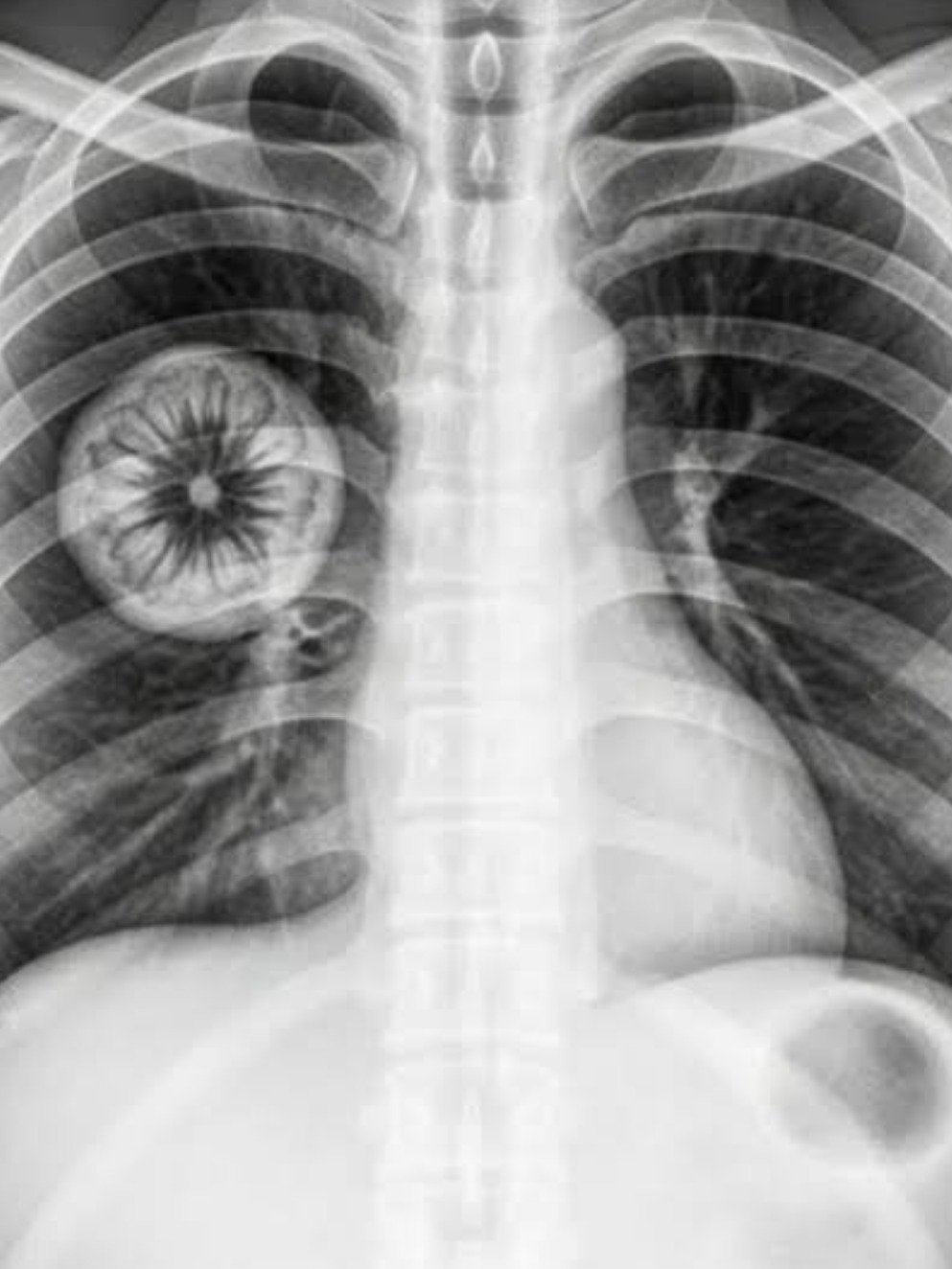 Vaccins Covid-19 : Faut-il vraiment craindre des effets à long terme ? Ce que la science révèle enfin