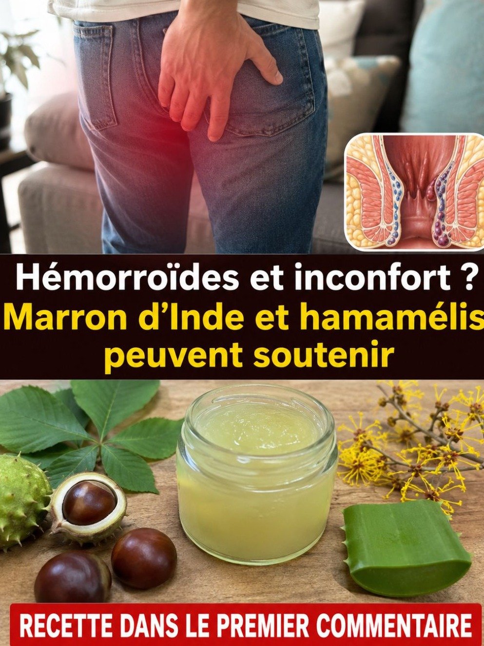 Adieu l'Inconfort Assis ! 3 Recettes Naturelles ÉTONNANTES pour Soulager Vos Hémorroïdes Instantanément