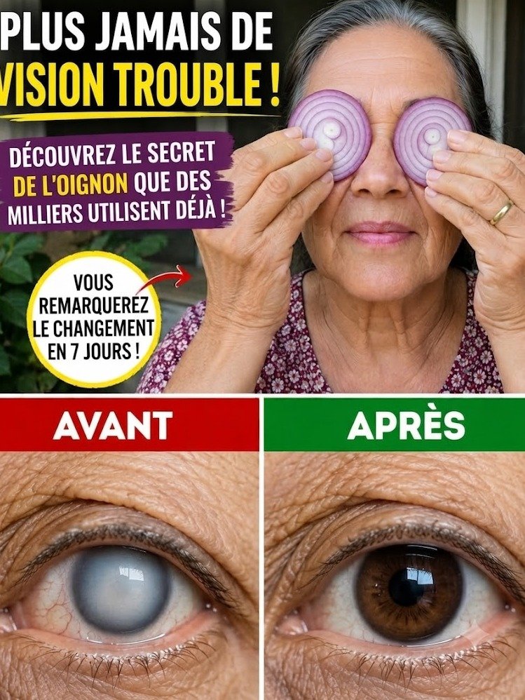 Le Secret Insoupçonné de l'Oignon pour une Vision Éclatante et des Yeux Plus Légers : Ne Manquez Pas Ça !