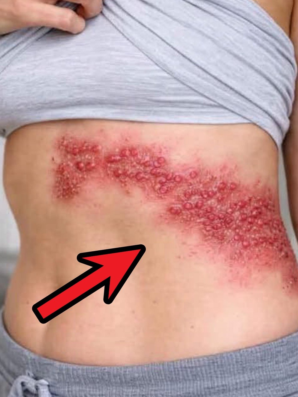 Révélation Choc : 15 Signes SILENCIEUX que votre Foie est en Détresse (Ne les ignorez PLUS !)