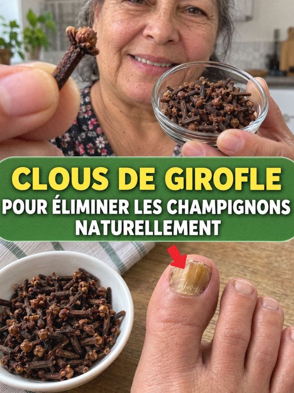 Adieu mycoses ! Découvrez le remède naturel 100% efficace pour des ongles sains en un temps record