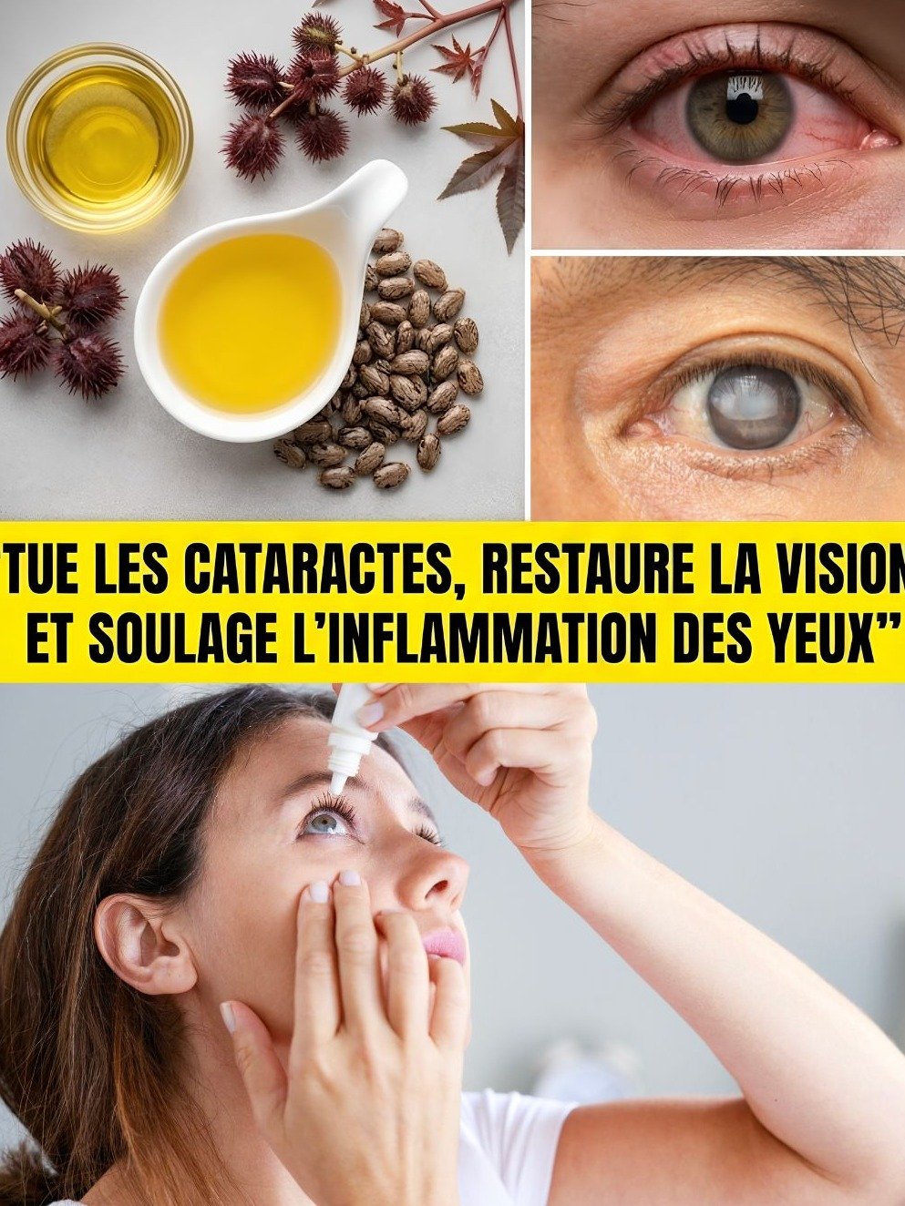 STOP aux Cataractes et Yeux Inflammés ! Découvrez LE Remède Naturel Ultime que Personne Ne Vous Dit