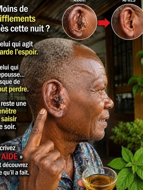 Ce sifflement infernal dans l'oreille qui vous réveille la nuit? Découvrez les 3 raisons URGENTES pour lesquelles il s'aggrave (et ce que vous ratez!)