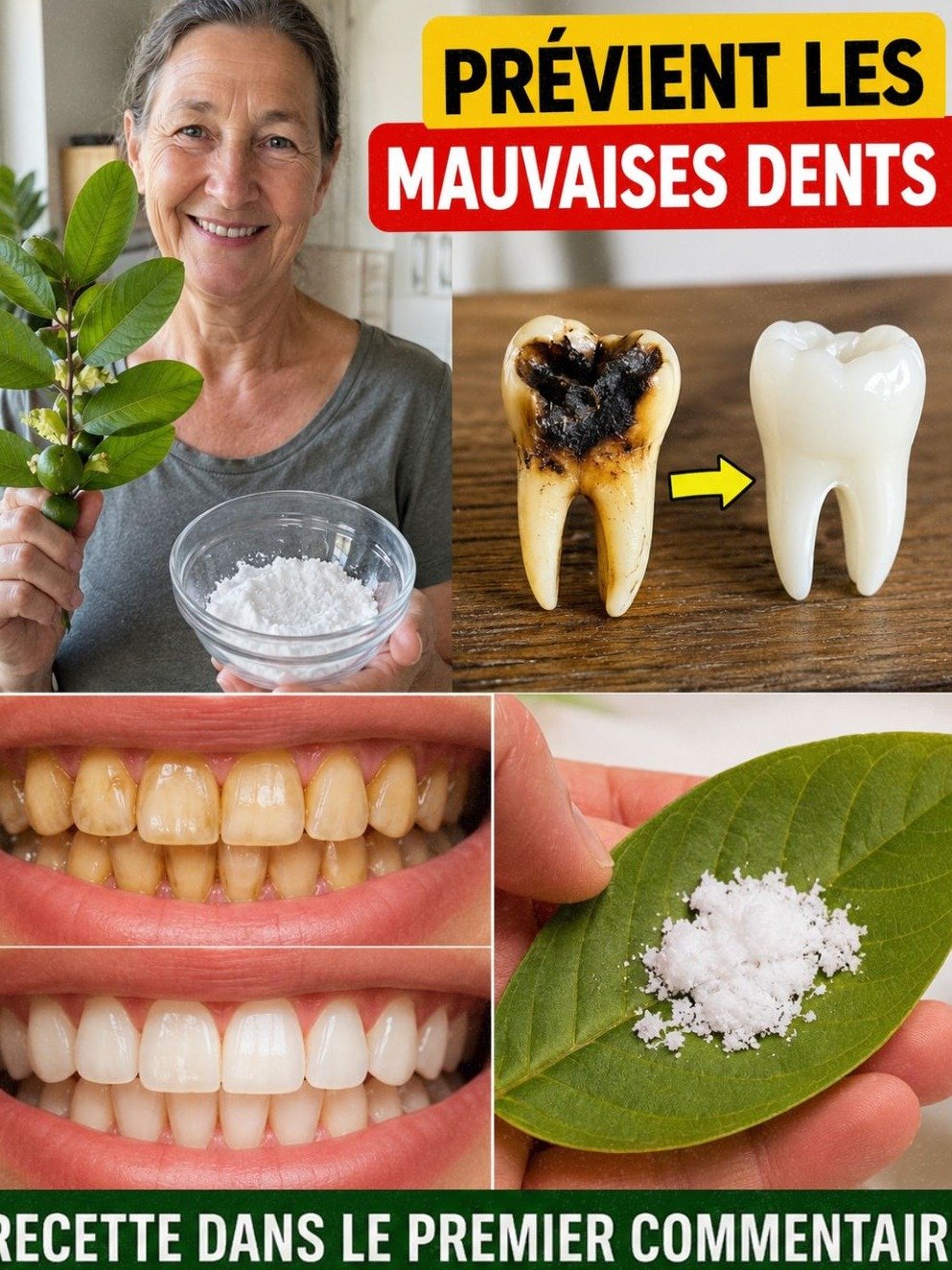 Le secret NATUREL pour ÉRADIQUER les caries ? Découvrez ces 3 remèdes aux feuilles de goyave avant qu'il ne soit trop tard !