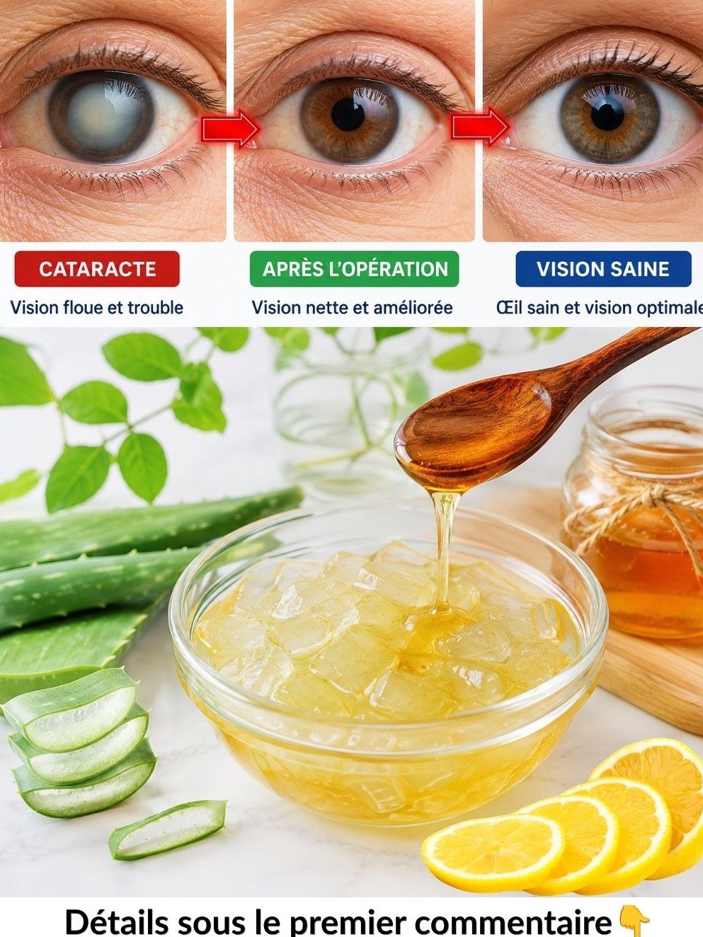 Le Secret Millénaire Révélé : 3 Ingrédients Simples (Aloe Vera, Miel, Citron) Pour des Yeux Éclatants et un Corps au Top !