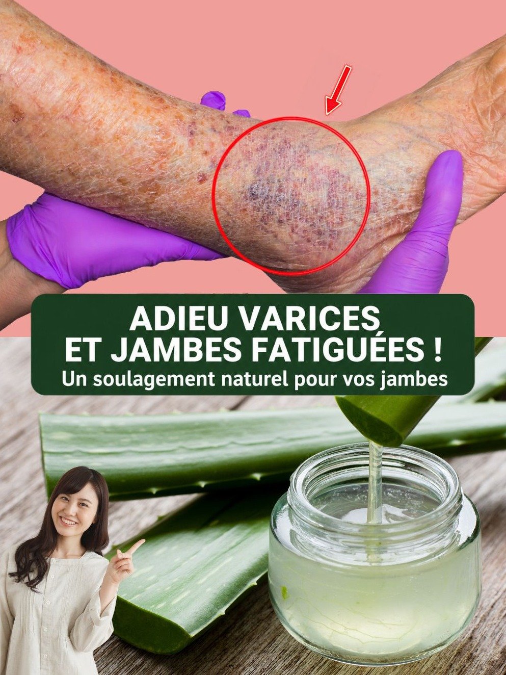Révélation : Dites Adieu aux Jambes Lourdes et Varices ! 5 Recettes Secrètes à l'Aloe Vera pour une Légèreté Instantanée que Vous DEVEZ Connaître