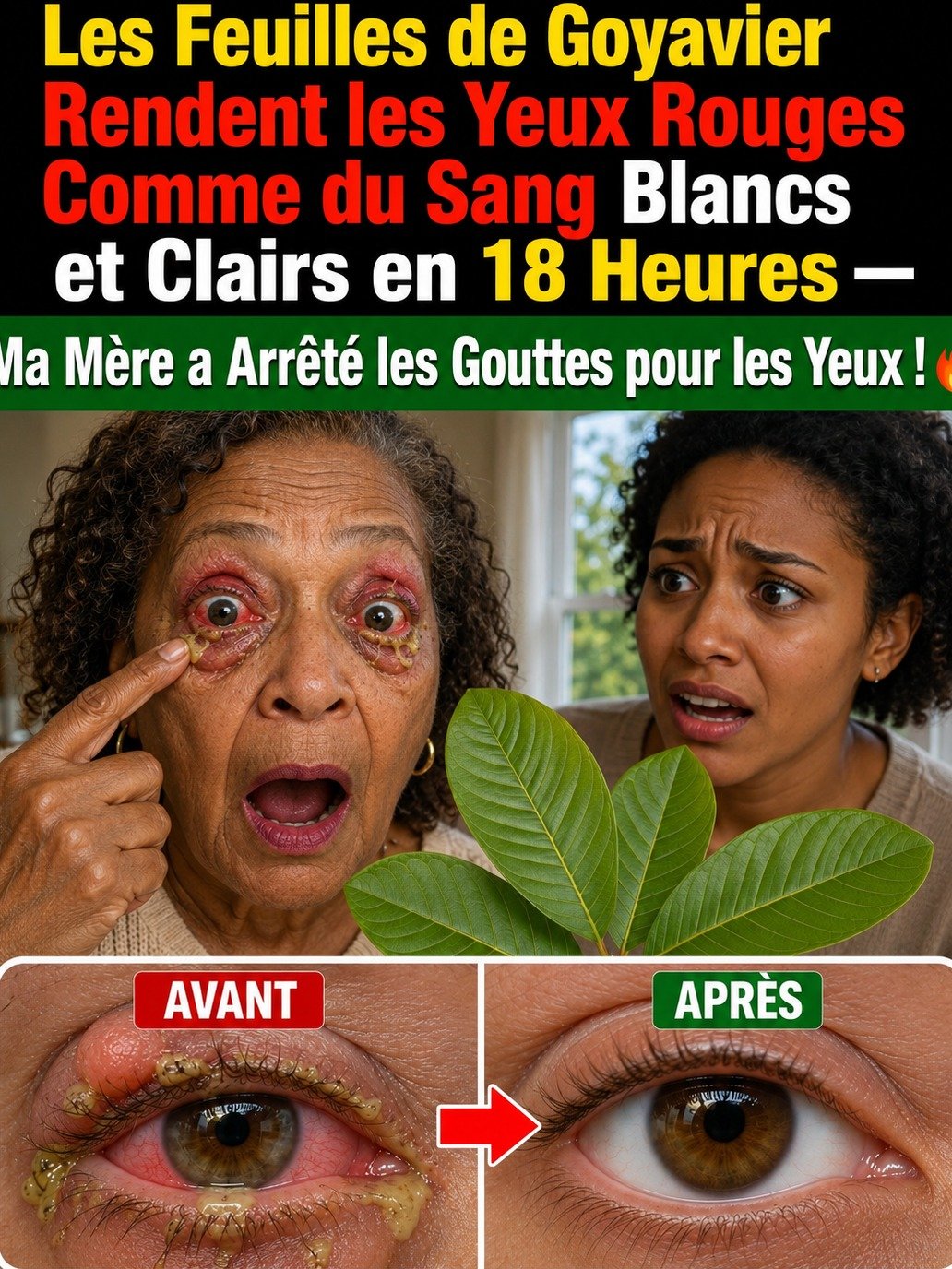 Le Secret Viral Oublié : Comment des Feuilles de Goyavier Peuvent Transformer Vos Yeux Rouges et Fatigués en une Nuit !