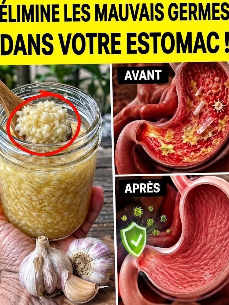 Le secret viral de l'ail : pourquoi cet aliment banal déclenche un nettoyage intestinal que les bactéries redoutent