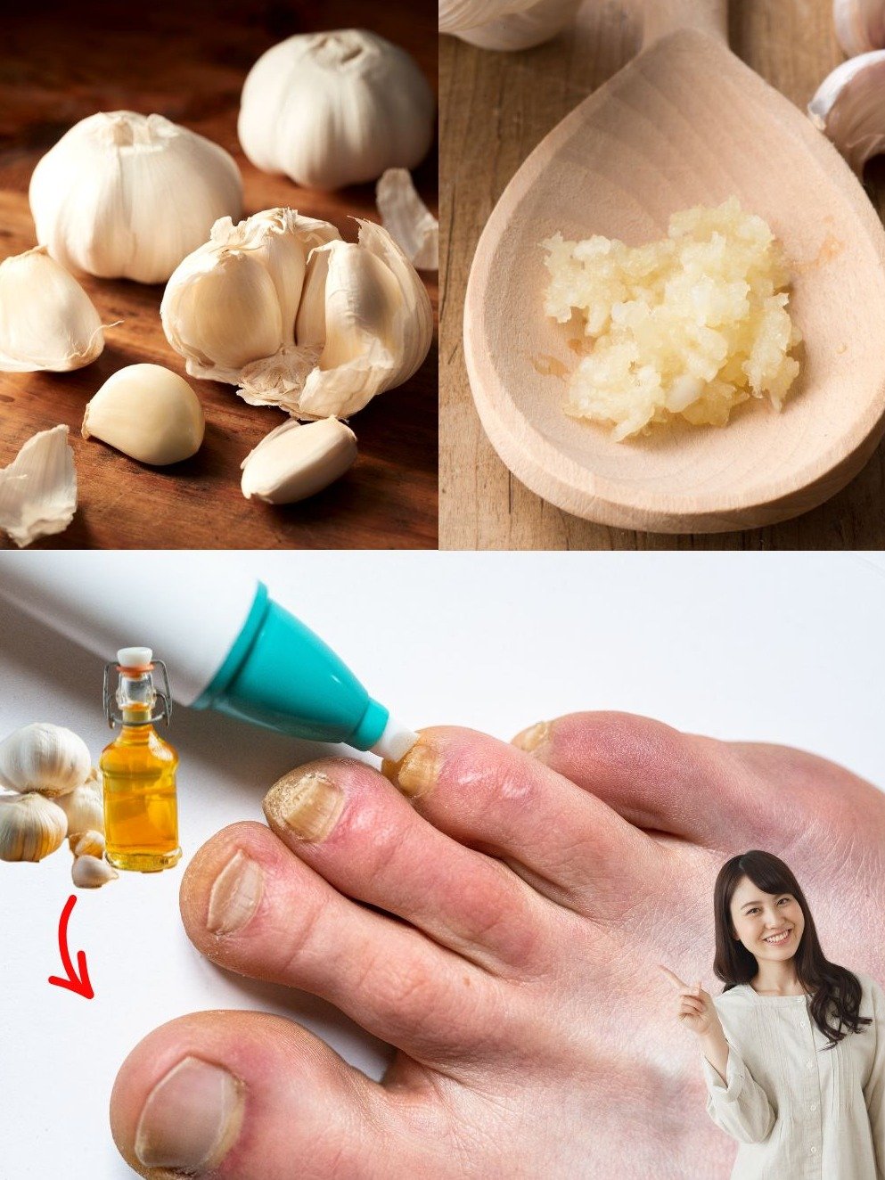 Le Secret Anti-Mycose le Mieux Gardé : Comment l'Ail Va Transformer Votre Peau et Vos Ongles (Tête, Mains, Pieds) – Ne Passez Pas À Côté !