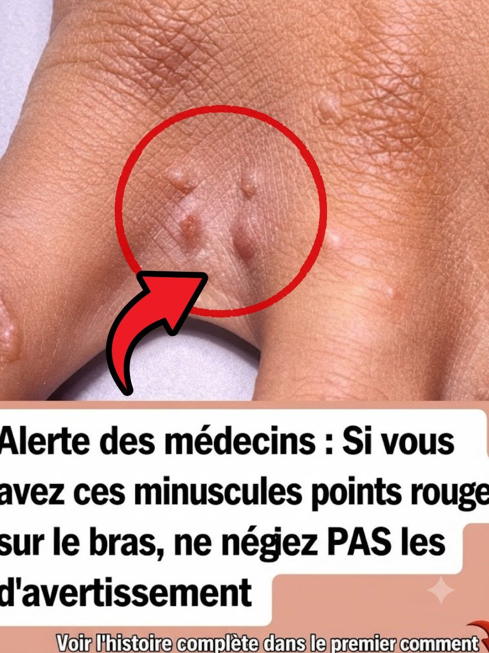 11 POINTS ROUGES sur Votre Peau ? Ce que Vous DEVEZ Savoir MAINTENANT (Le N°7 Peut Être Dangereux) !