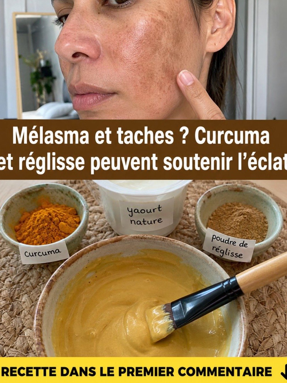 STOP Mélasma & Taches ! Le Secret Naturel au Curcuma que TOUT LE MONDE S'ARRACHE pour une Peau Zéro Défaut