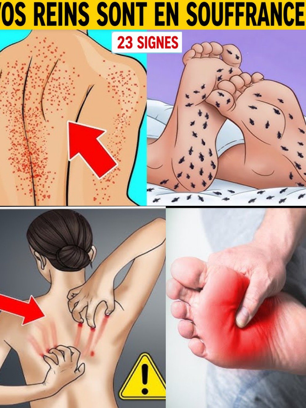 Ne Manquez PAS Ces 23 Signes Cruciaux : Vos Reins Vous Lancent un SOS (Agissez Avant Qu'il Ne Soit Trop Tard !) 🚨