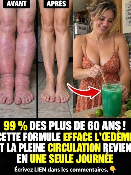 Jambes gonflées ? Oubliez la boisson miracle ! Voici la VRAIE raison et la solution que vous devez connaître URGEMMENT.